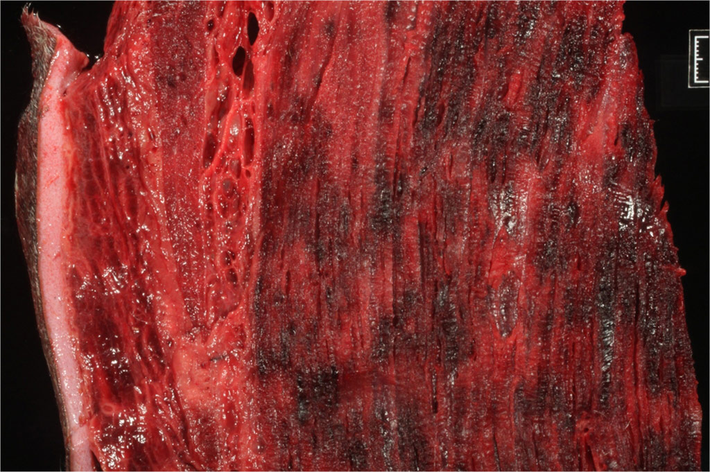 cut surface of skeletal muscle with large, multifocal dark red to black areas