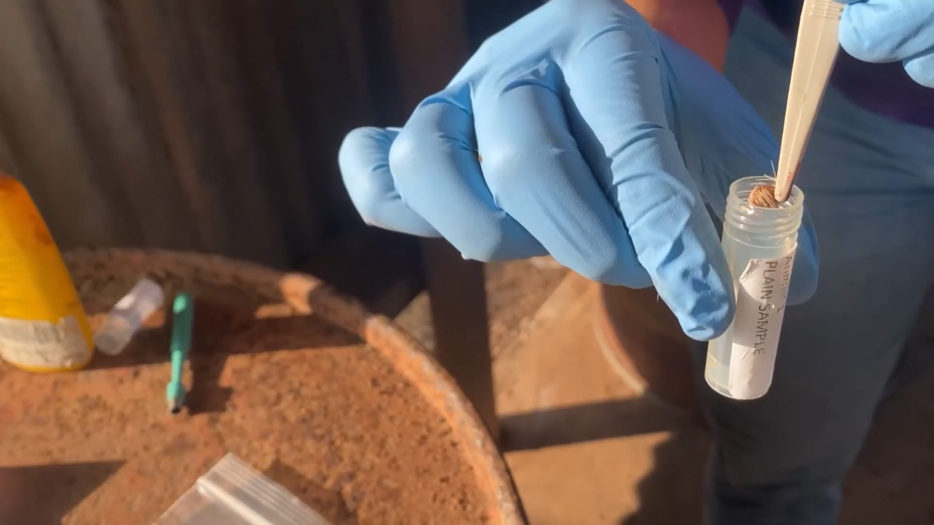 Placing a fresh skin sample into a sterile tube